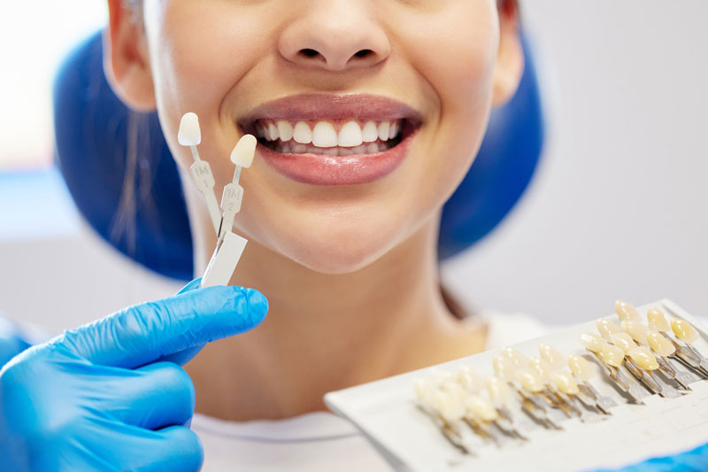 a patient getting a color match on her teeth so she can get veneers